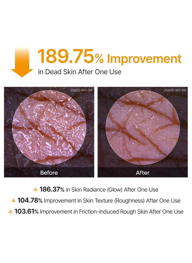 Dr Melaxin Peel Shot skincare feature